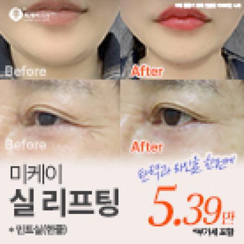미케이 맞춤형 민트실 동안 리프팅_팔자, 이중턱, 눈가