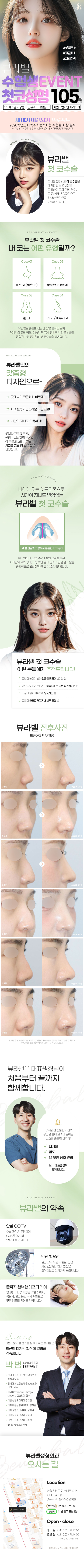 뷰라밸 수험생 이벤트 첫코성형_박범대표원장