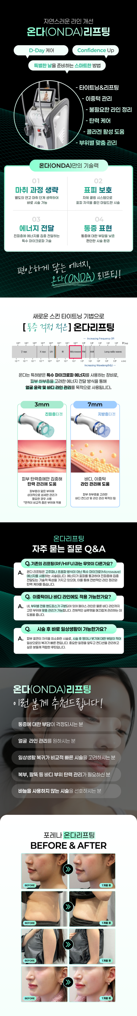 온다리프팅