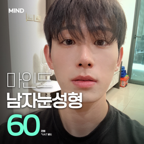 마인드성형외과의원