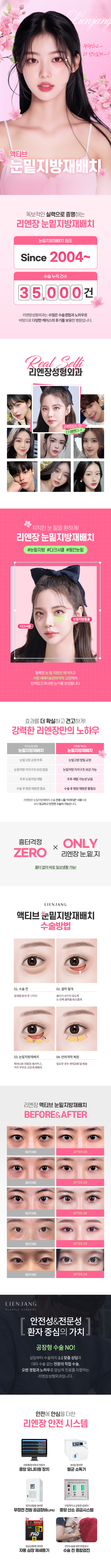 리엔장_액티브 눈밑지방재배치