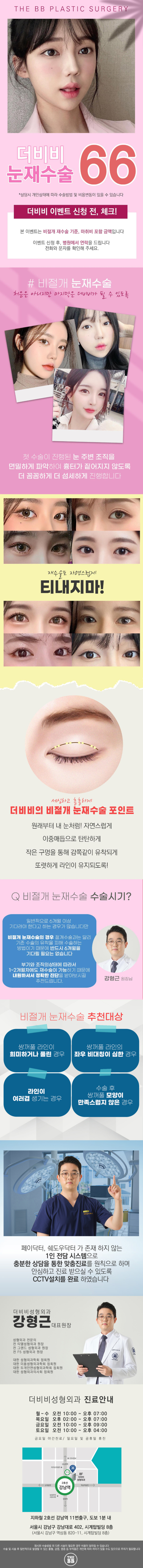 더비비 눈재수술