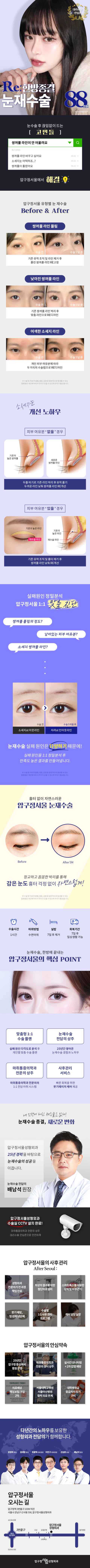 한방종결 눈재수술_소세지눈 