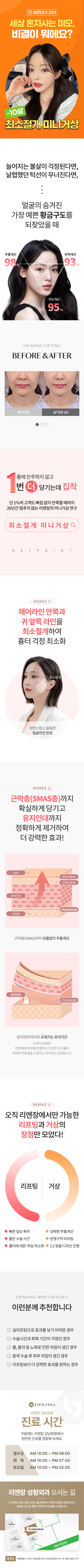리엔장 최소절개 미니거상
