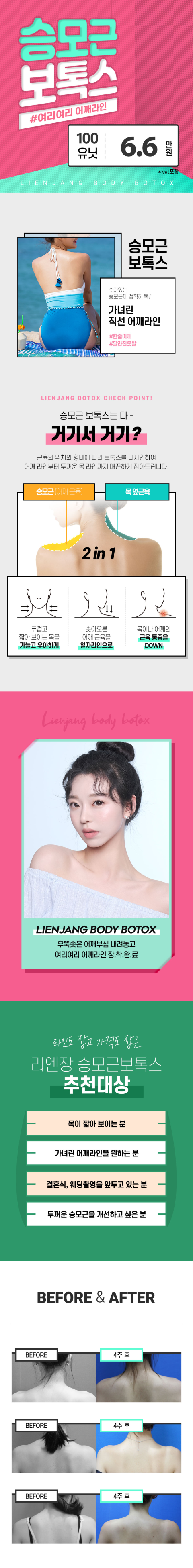 여리여리 승모근보톡스