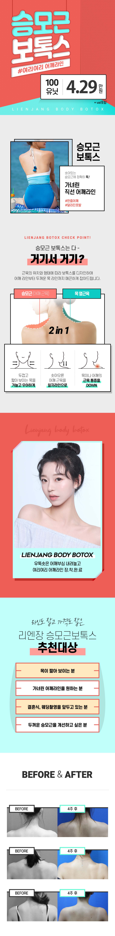 홍대 승모근보톡스