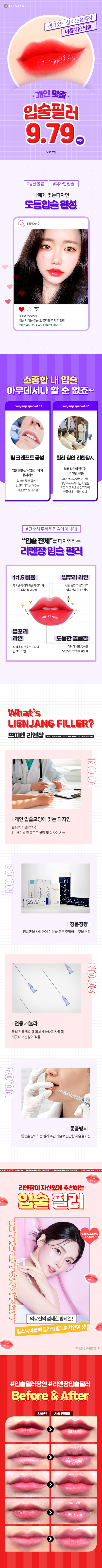 인천 입술필러 심쿵볼륨