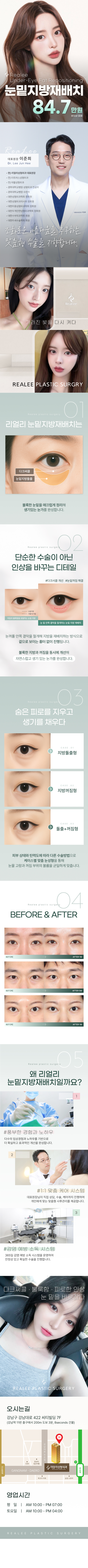 리얼리 눈밑지방재배치