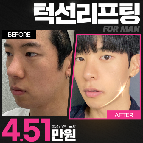 팽팽의원